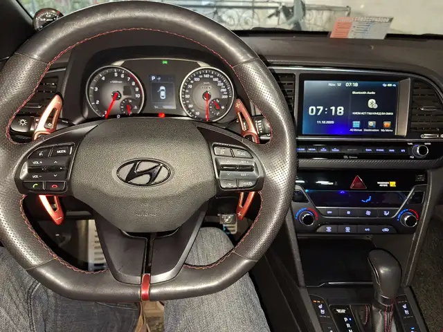 Hyundai Avante 2017 - Выбор фото 1